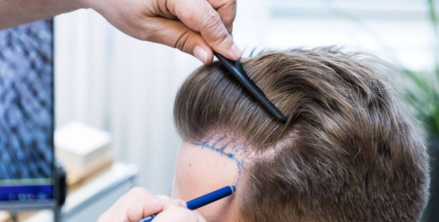 Ankara Saç Ekim Merkezleri