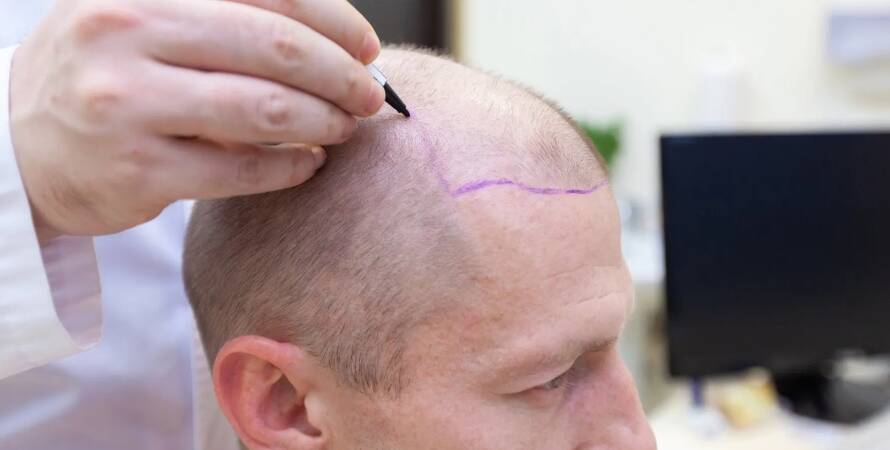 Antalya Saç Ekim Merkezleri