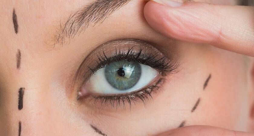 İzmir Göz Kapağı Estetiği Doktorları