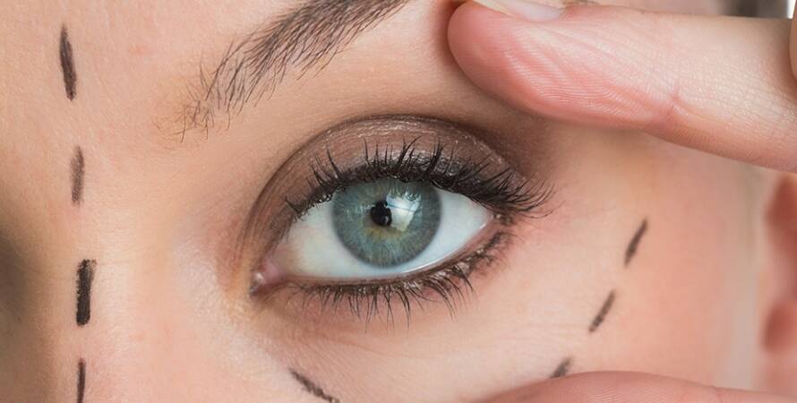 İzmir Göz Kapağı Estetiği Doktorları