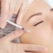Botoks (Botox) İzmir