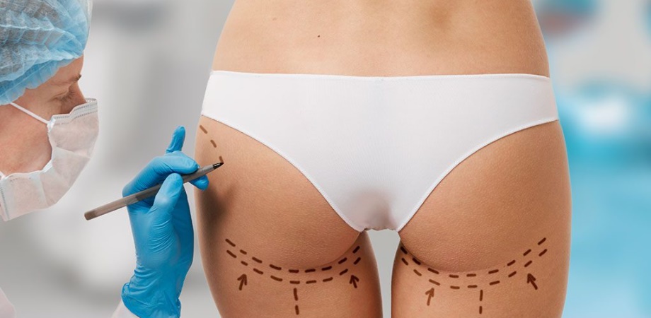 5 En İyi Ankara Liposuction Doktoru
