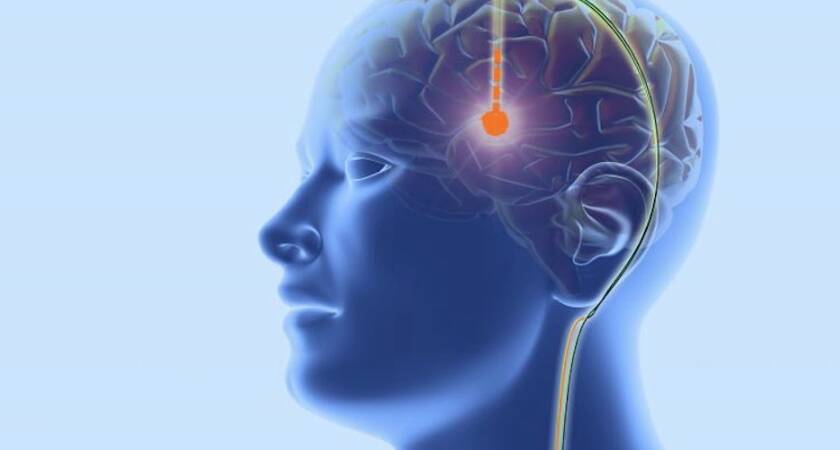 İzmir Beyin Cerrahisi Doktorları