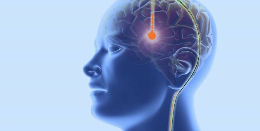 İzmir Beyin Cerrahisi Doktorları