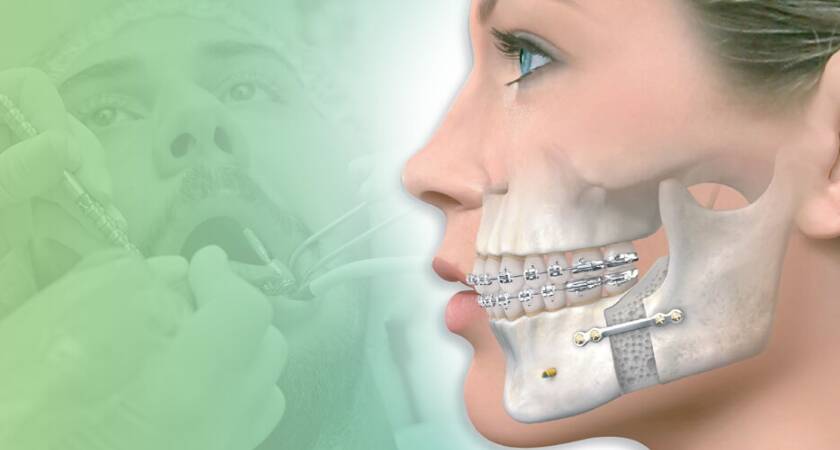 İzmir Çene Cerrahisi Doktorları