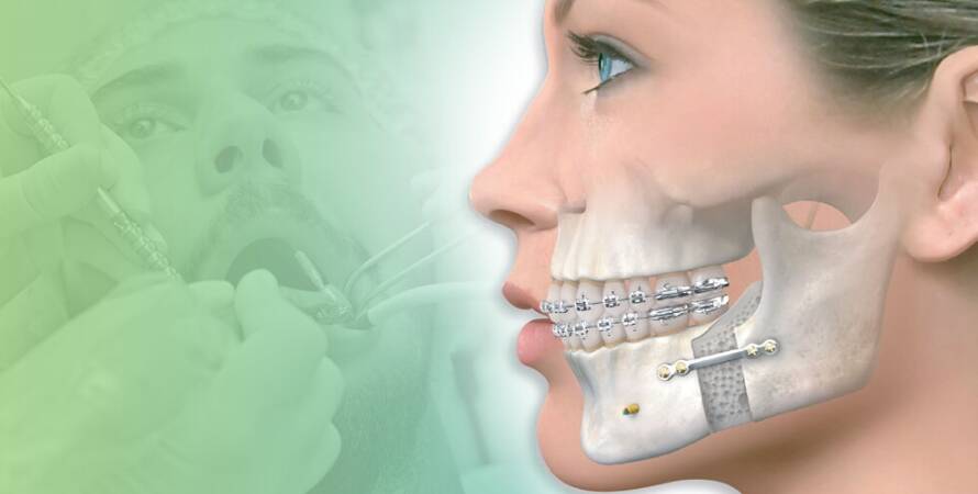 İzmir Çene Cerrahisi Doktorları