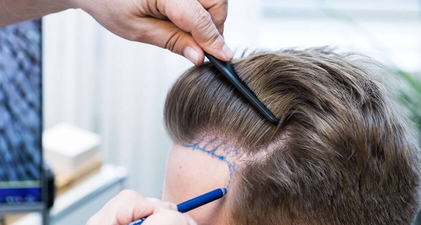 Ankara Saç Ekim Merkezleri