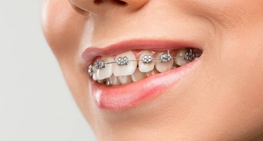 İstanbul Ortodonti Uzmanları (Ortodontist)