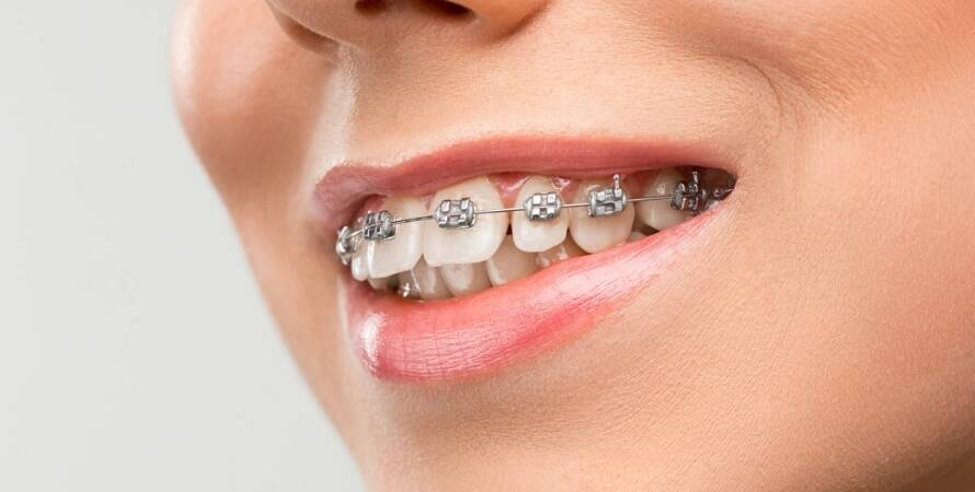 İstanbul Ortodonti Uzmanları (Ortodontist)