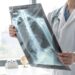 Antalya Akciğer (Göğüs Hastalıkları) Doktorları