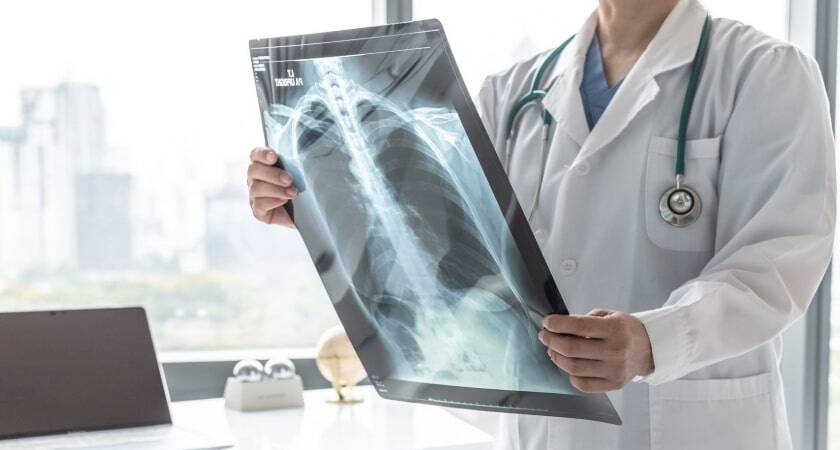 Antalya Akciğer (Göğüs Hastalıkları) Doktorları