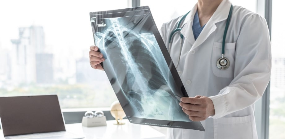 5 En İyi Antalya Akciğer Doktoru