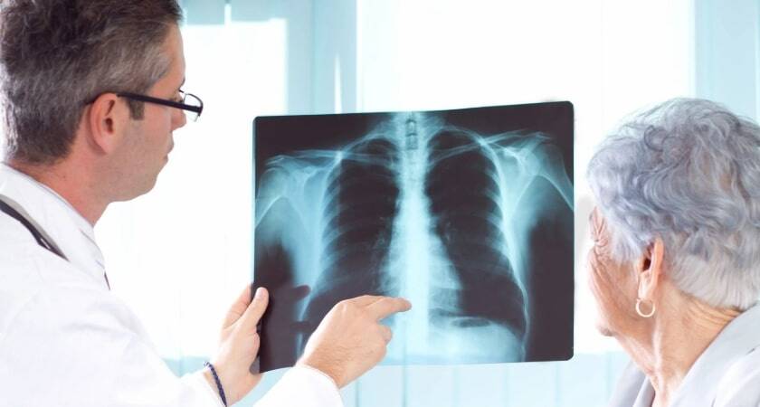 İstanbul Akciğer (Göğüs Hastalıkları) Doktorları