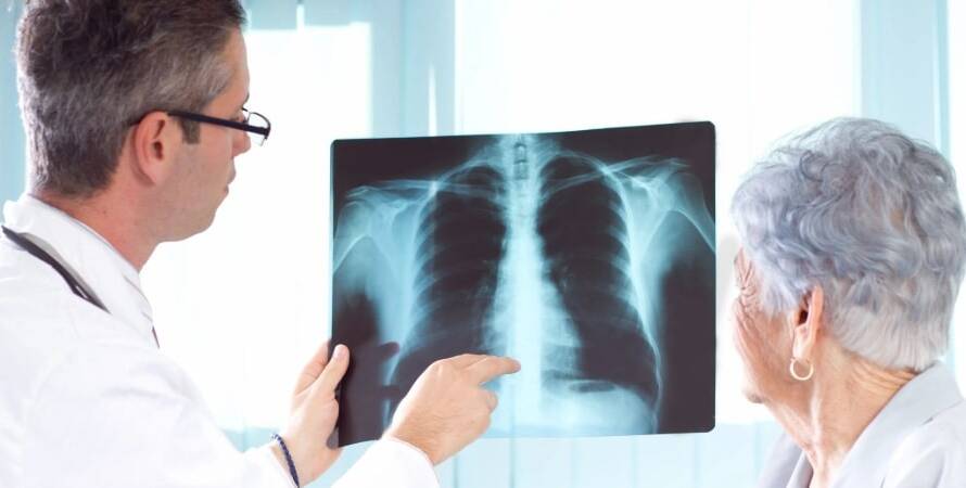 İstanbul Akciğer (Göğüs Hastalıkları) Doktorları