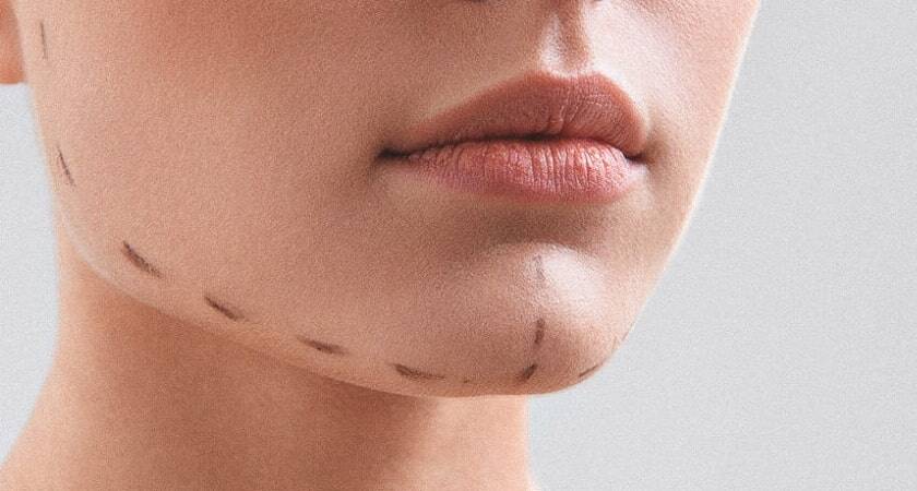 İstanbul Çene Cerrahisi Doktorları