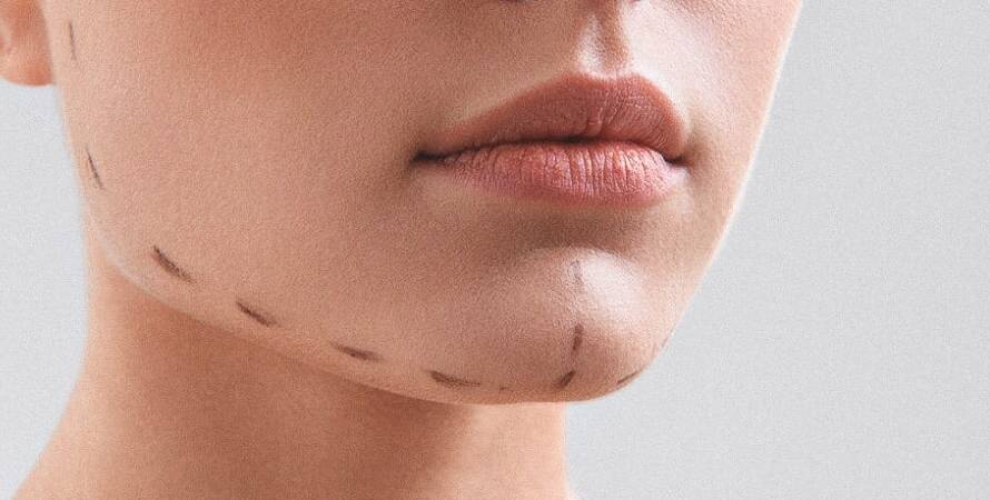 İstanbul Çene Cerrahisi Doktorları