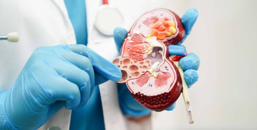 Türkiye Üroloji Doktorları