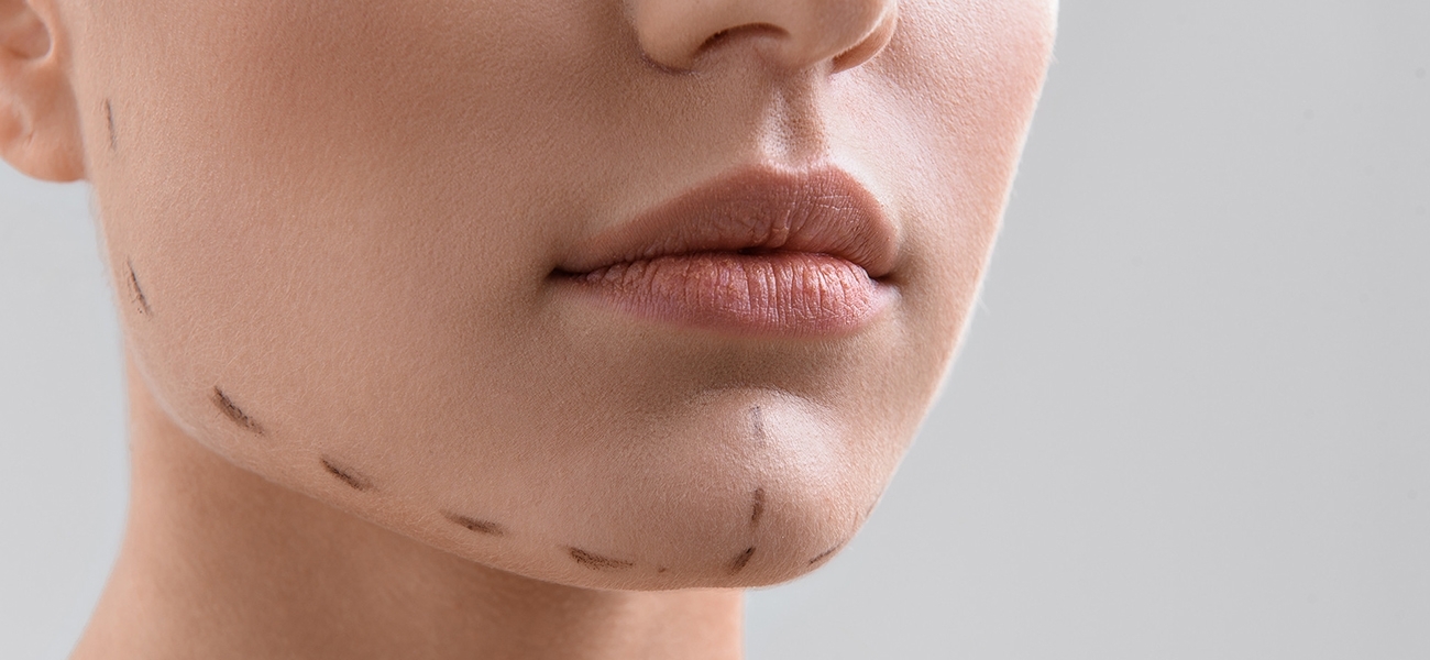 İstanbul Çene Dolgusu (Jawline) Doktorları